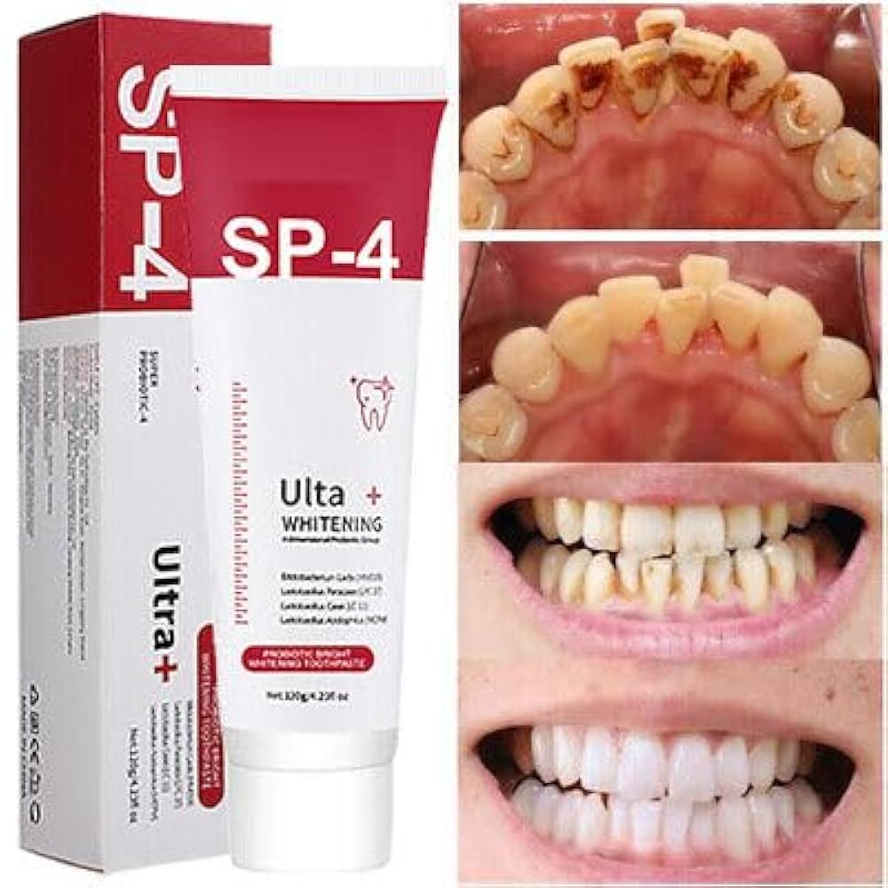 SP-4 toothpaste packaging with before and after dental whitening results.
