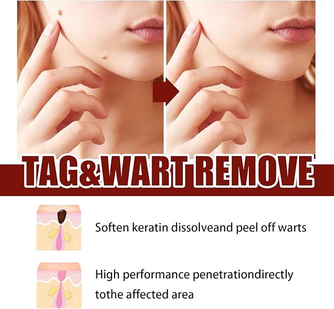 Tag & Mole Remover Pen