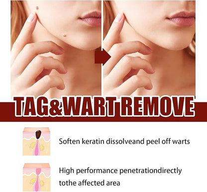 Tag & Mole Remover Pen